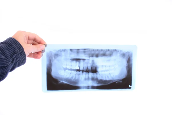 Стоматологическое фото — стоковое фото
