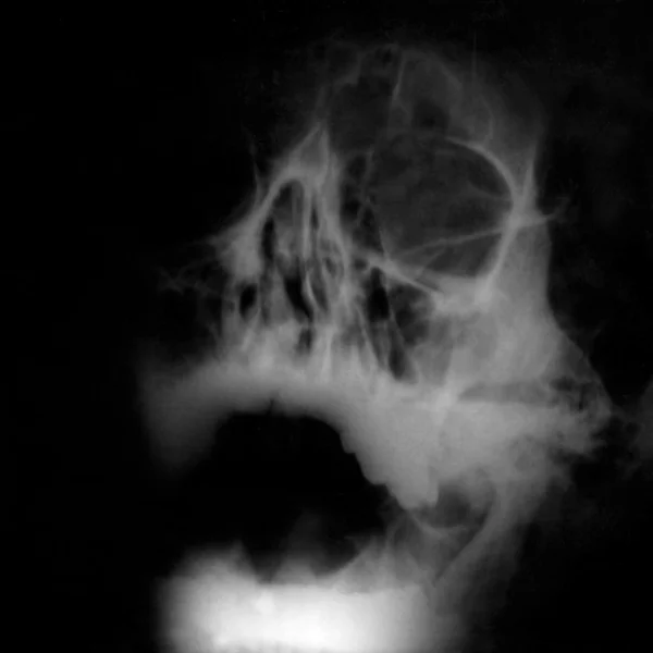 Imagem de raios X — Fotografia de Stock
