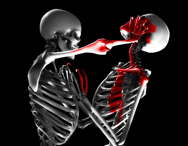 stock image Fighting Skeletons