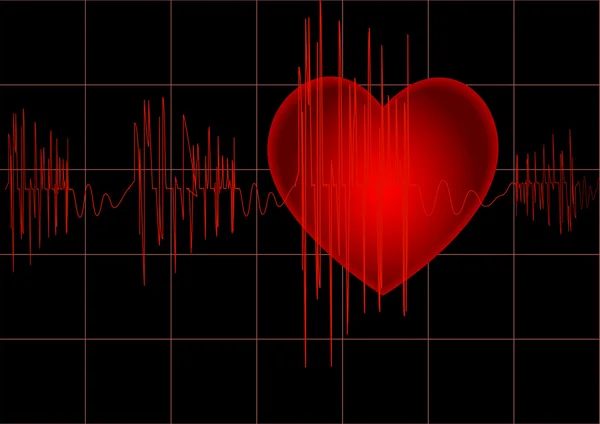 El cardiograma — Vector de stock