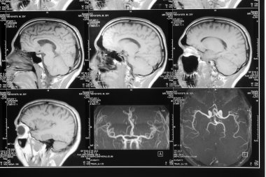 Head magnetic resonance image clipart