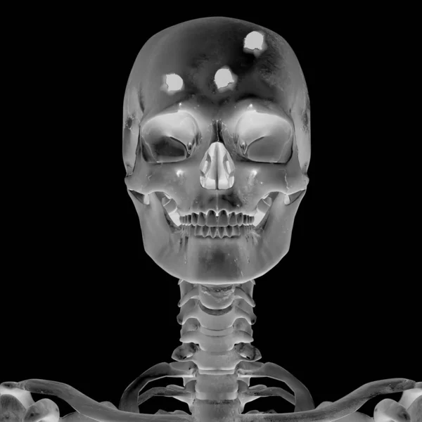Radiografia 3D com lesão na cabeça — Fotografia de Stock