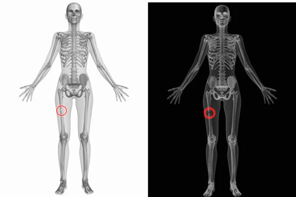 人体解剖学与断骨 — 图库照片