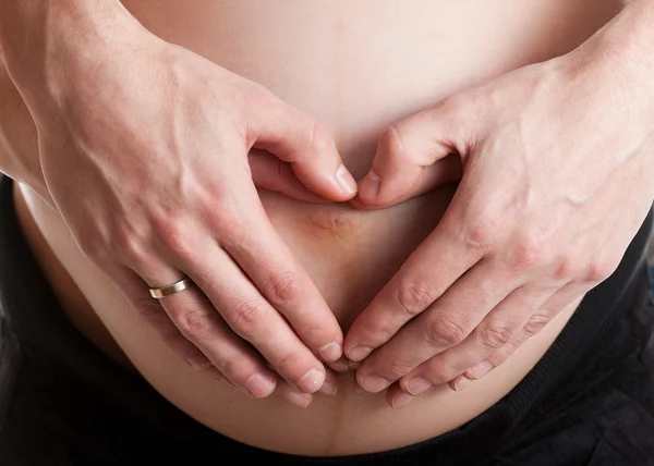 Pancia incinta avanzata con le mani Foto Stock