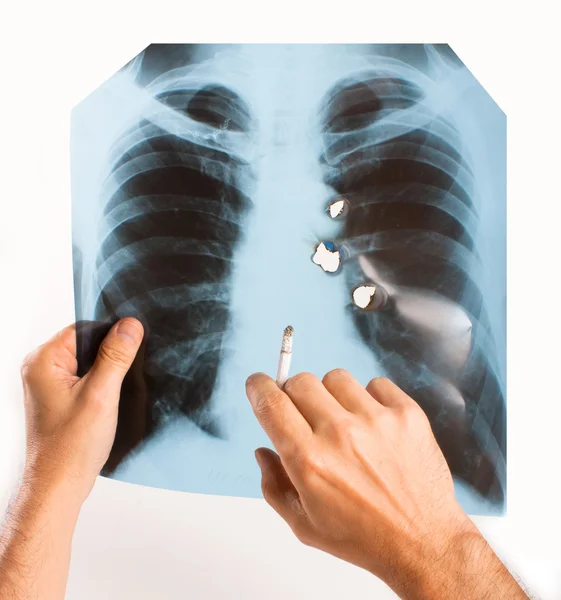 stock image X-ray lung