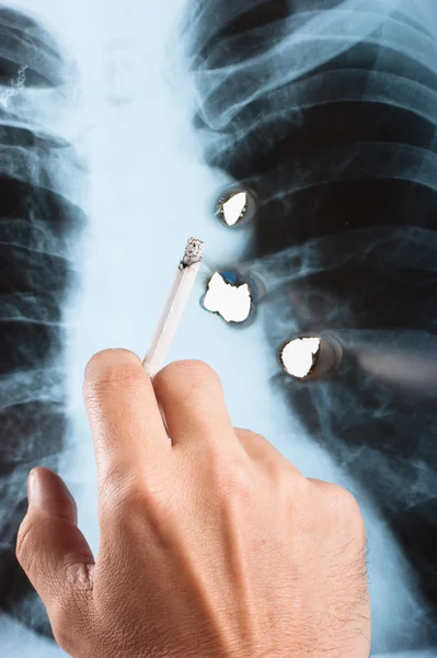 stock image X-ray lung
