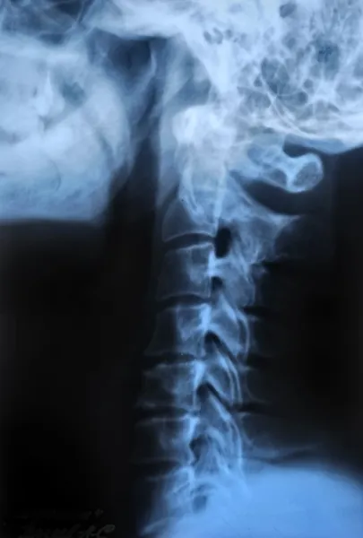 Рентгенівський знімок людського тіла — стокове фото