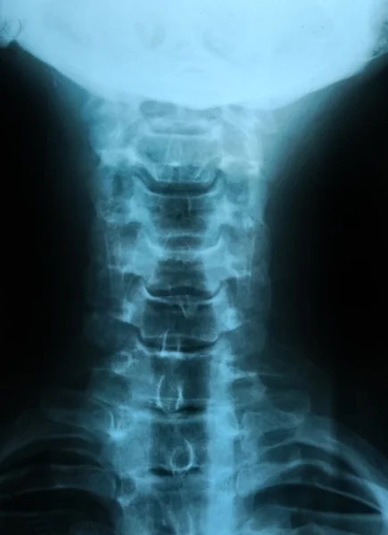 Radiografía del cuerpo humano — Foto de Stock