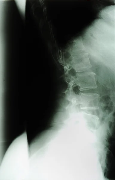 Radiografia do corpo humano — Fotografia de Stock