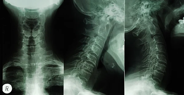 Emberi test röntgenfelvétel — Stock Fotó