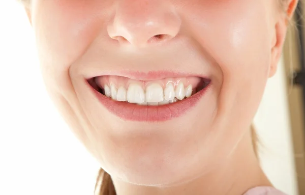 Dentes visíveis — Fotografia de Stock