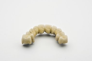 Dental prosthesis clipart
