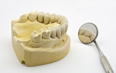 Dental prosthesis clipart