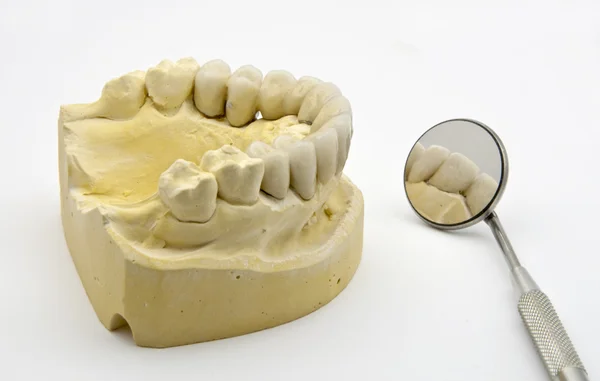 Οδοντιατρική πρόθεση — Φωτογραφία Αρχείου