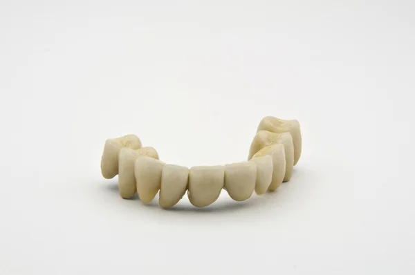 Protesi dentaria — Foto Stock