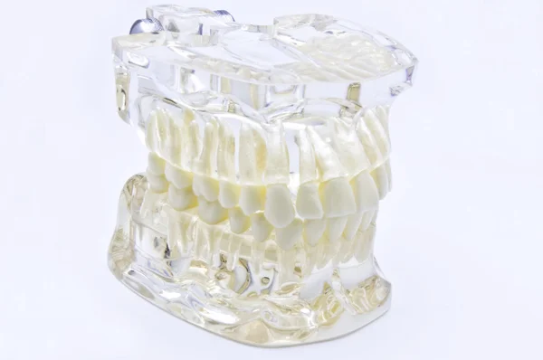 Οδοντιατρική μοντέλο — Φωτογραφία Αρχείου