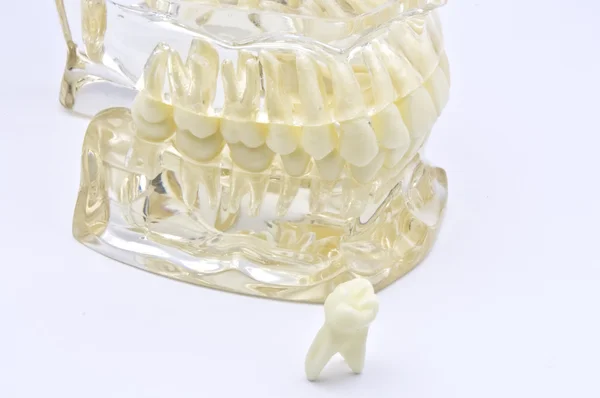 Стоматологическая модель — стоковое фото