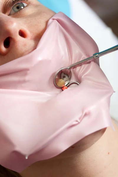 Лечение зубов — стоковое фото
