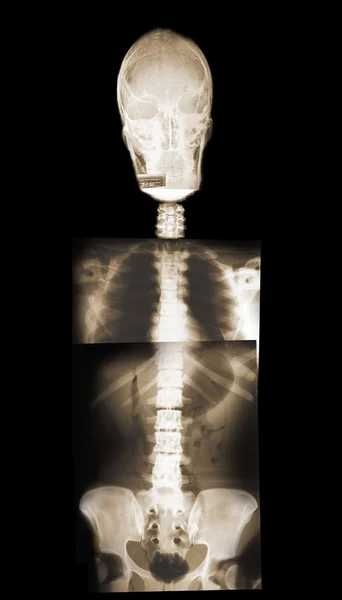 Imágenes de rayos X del esqueleto humano — Foto de Stock
