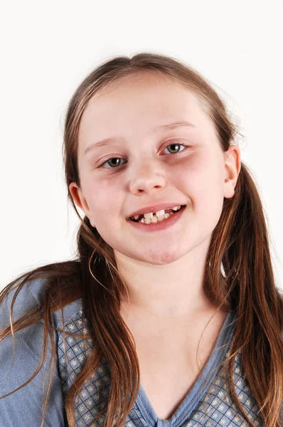 stock image Young girl with missing teethes.
