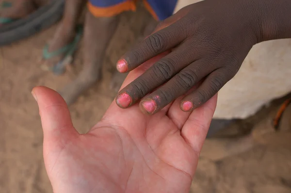 Ręce afrykańskich — Zdjęcie stockowe