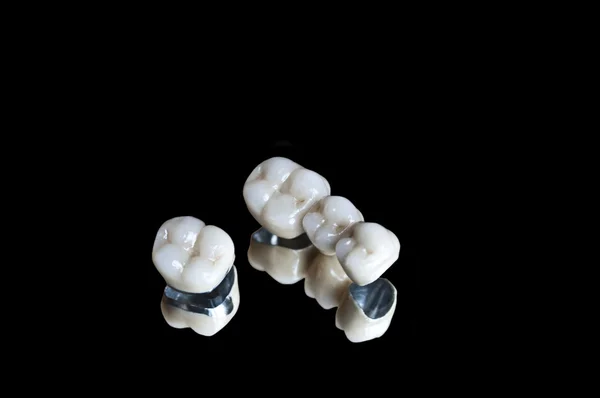 Keramische tanden — Stockfoto