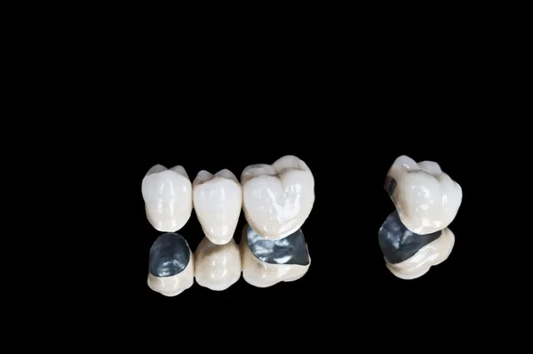 Ceramic teeth — Stock Photo, Image