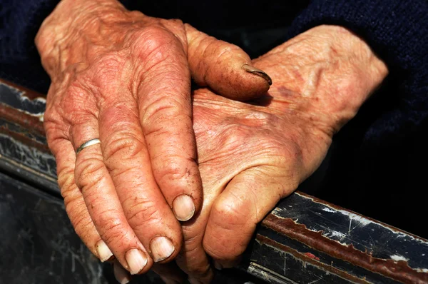 Trabalho duro mãos de uma senhora idosa — Fotografia de Stock