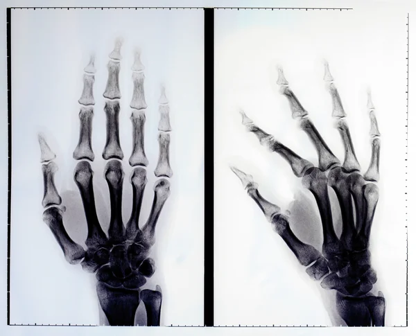 Рентген — стоковое фото