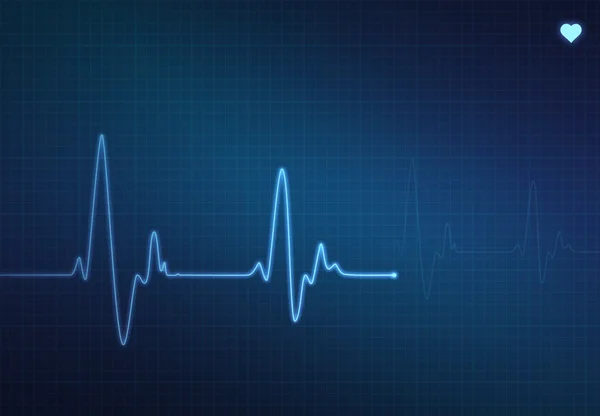 Heartbeat Monitor — Stock Photo, Image