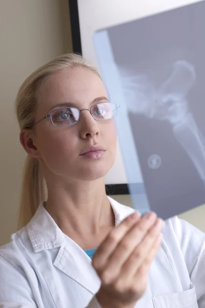 엑스레이를 보고 있는 의사 — 스톡 사진