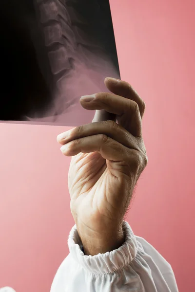 Doctor's hand holding x-ray — Stock Photo, Image
