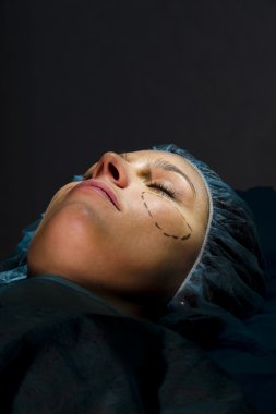 Operasyon plastik alan kadın