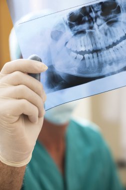 x-ışını inceleyerek diş hekimi
