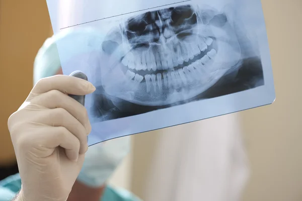 Primer Plano Del Dentista Examinando Rayos — Foto de Stock