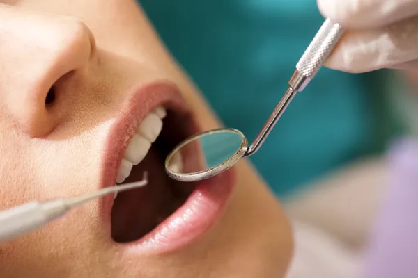 Beim Zahnarzt — Stockfoto