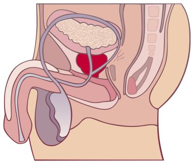 Prostate gland clipart