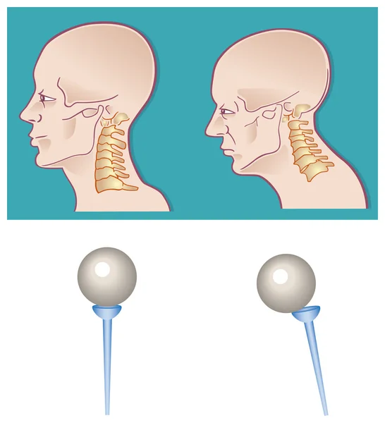 颈部脊柱 — 图库矢量图片