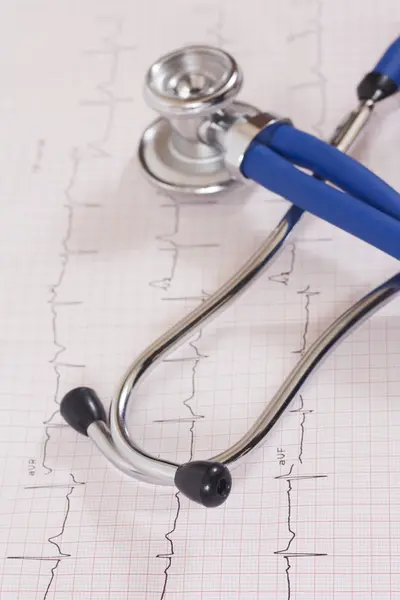 Medicinsk hjärtat test med blå stetoskop — Stockfoto