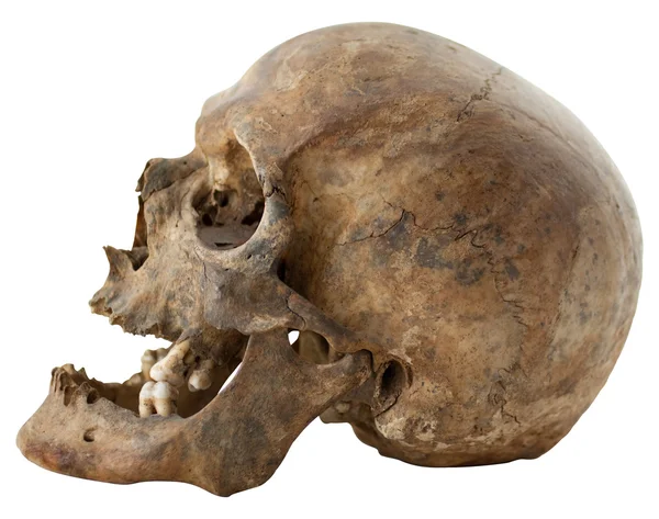 Human Skull — Stock Photo, Image