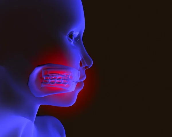 Zahnschmerzen — Stockfoto
