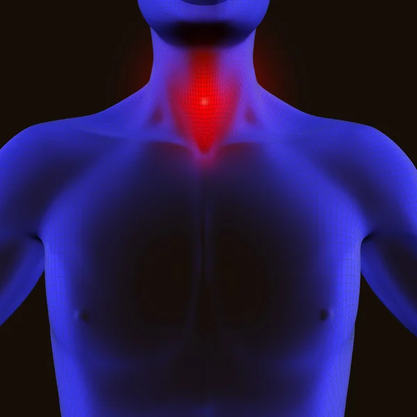 Біль у горлі — стокове фото