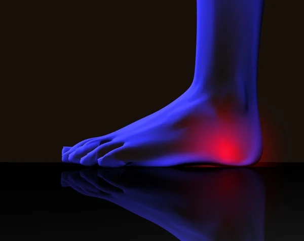 Foot and pain — Stock Photo, Image