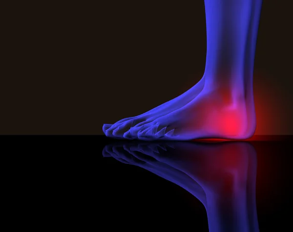 Fuß und Schmerz — Stockfoto
