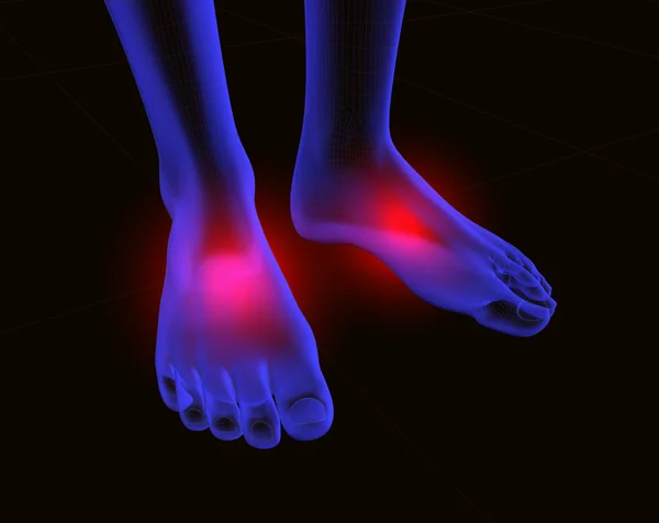 Ayak ve ağrı — Stok fotoğraf