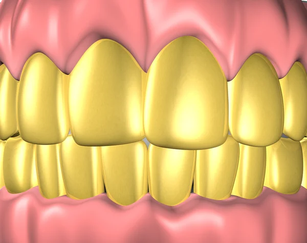 Denture — Stock Photo, Image